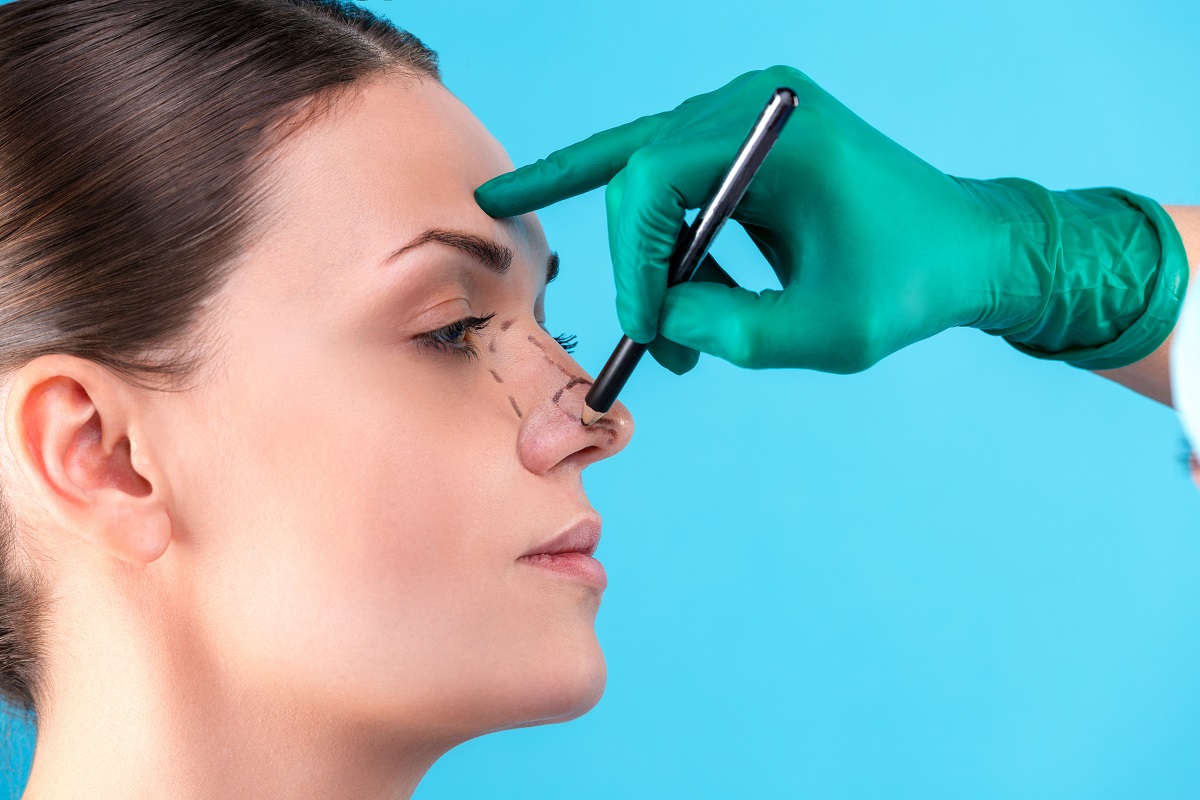 Revision Rhinoplasty in San Diego & La Jolla